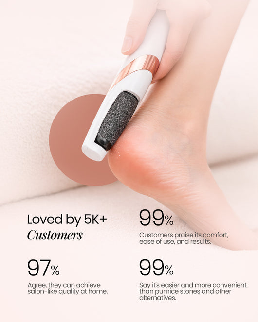 Feetee™ 3.0 Callus Remover